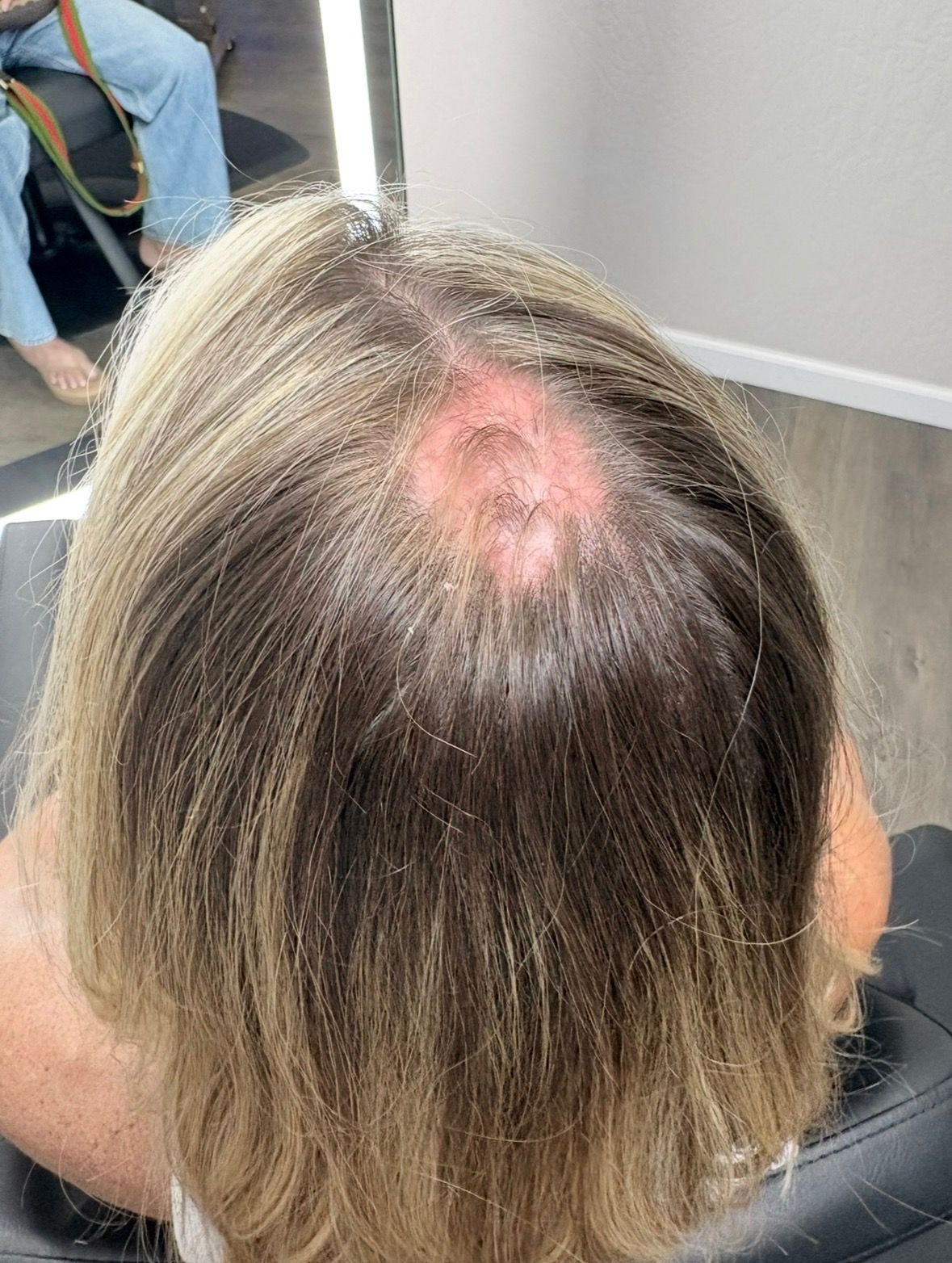Hair Topper